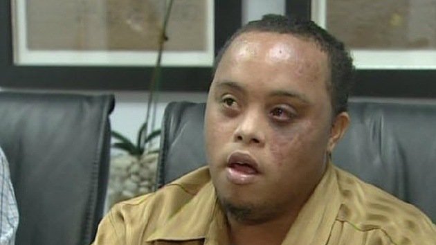Un joven con síndrome de Down, golpeado por un policía en EE.UU.