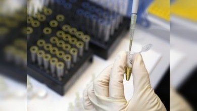 Un nuevo gel vaginal podría proteger a las mujeres del VIH