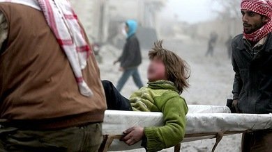 Colapso de la atención médica en Siria: ante la falta de anestesia, noquean con barras de metal