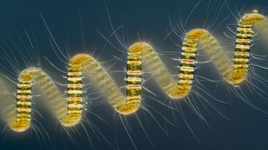 Belleza microscópica: las mejores fotos del año de lo más diminuto