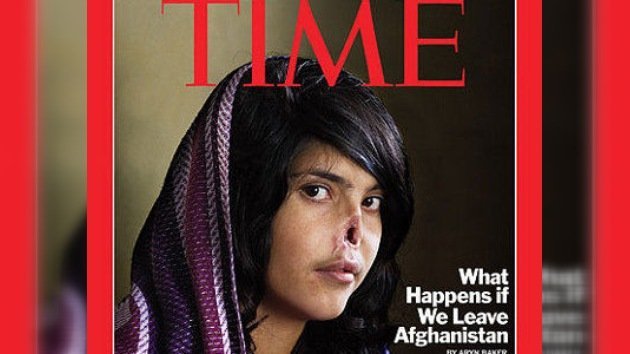 La foto de una joven afgana desfigurada triunfa en el World Press Photo