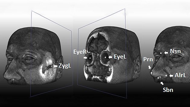 Los cinco genes que ‘dibujan’ la cara humana