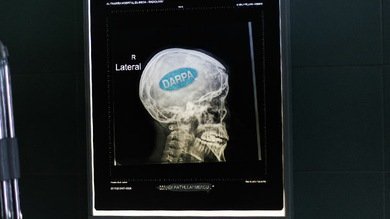 El Pentágono desarrolla implantes cerebrales para restaurar recuerdos
