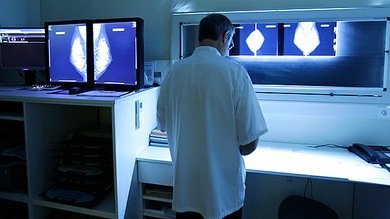 Una mutación genética protege a las latinas del cáncer de mama