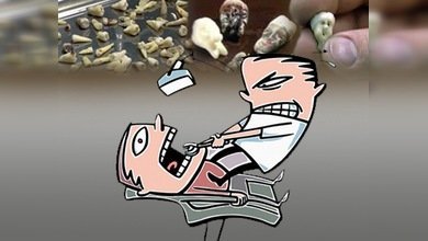 Un dentista siberiano talla netsukes de muelas extirpadas