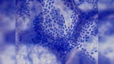 Alemania ya sabe por qué mata la bacteria E.Coli