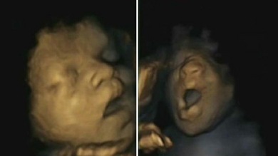 Foto: Los bebés aprenden a anticipar y coordinar sus gestos en el útero