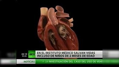 Cardiocirujanos rusos salvan a los más pequeños