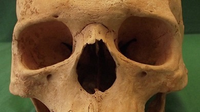 'Resucitan' a la lepra medieval y descubren por qué acabó la epidemia en Europa