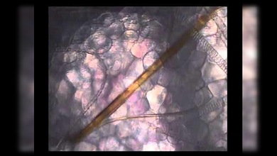 ¿Qué sucede dentro del cuerpo cuando nos pica un mosquito?