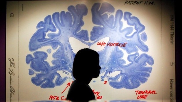 El cerebro tiene truco: Las 7 formas que tiene de engañar a nuestros cinco sentidos