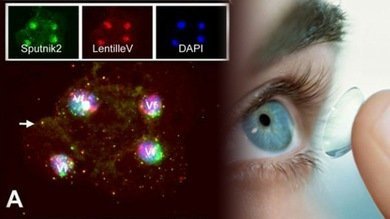 Descubren un gigantesco virus con triple parasitismo en un líquido para lentes