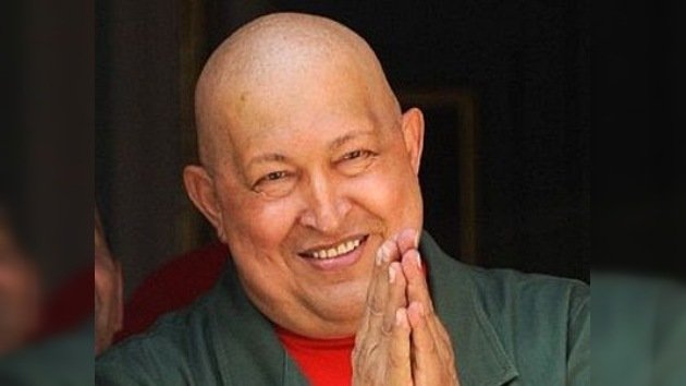 Hugo Chávez ha sido operado de nuevo del tumor cancerígeno que padecía