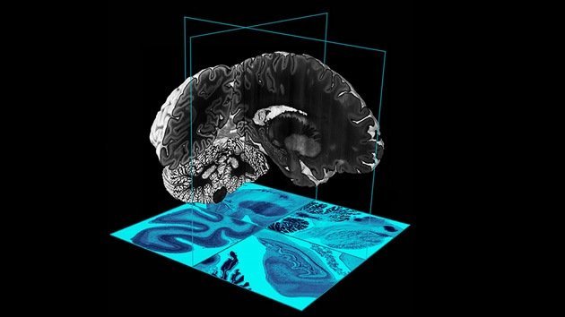 Video: Un ambicioso mapa 3D descubre el cerebro humano en toda su dimensión