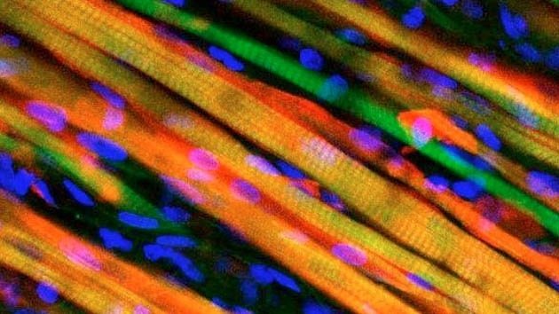Científicos logran crear un tejido muscular artificial capaz de regenerarse