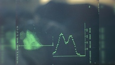 Inventos rusos para controlar la depresión y el crecimiento tumoral
