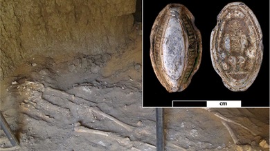 Hallado un cáncer de más de 3.000 años