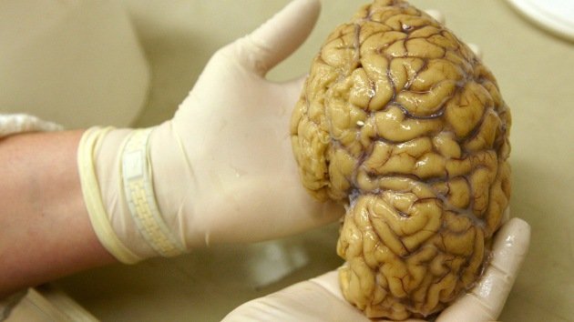 Neurólogo: "DARPA estudia implantar chips con memoria en el cerebro"