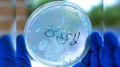 La bacteria letal E.Coli, bajo el microscopio ruso