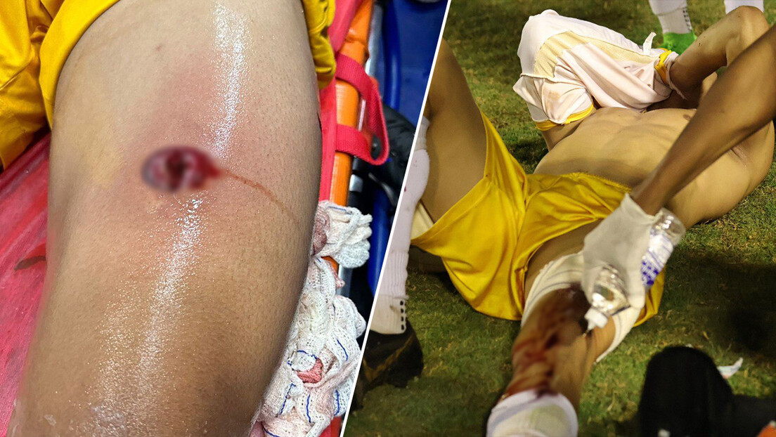 Policial dispara na perna de goleiro após confusão durante uma partida de futebol em Goiás