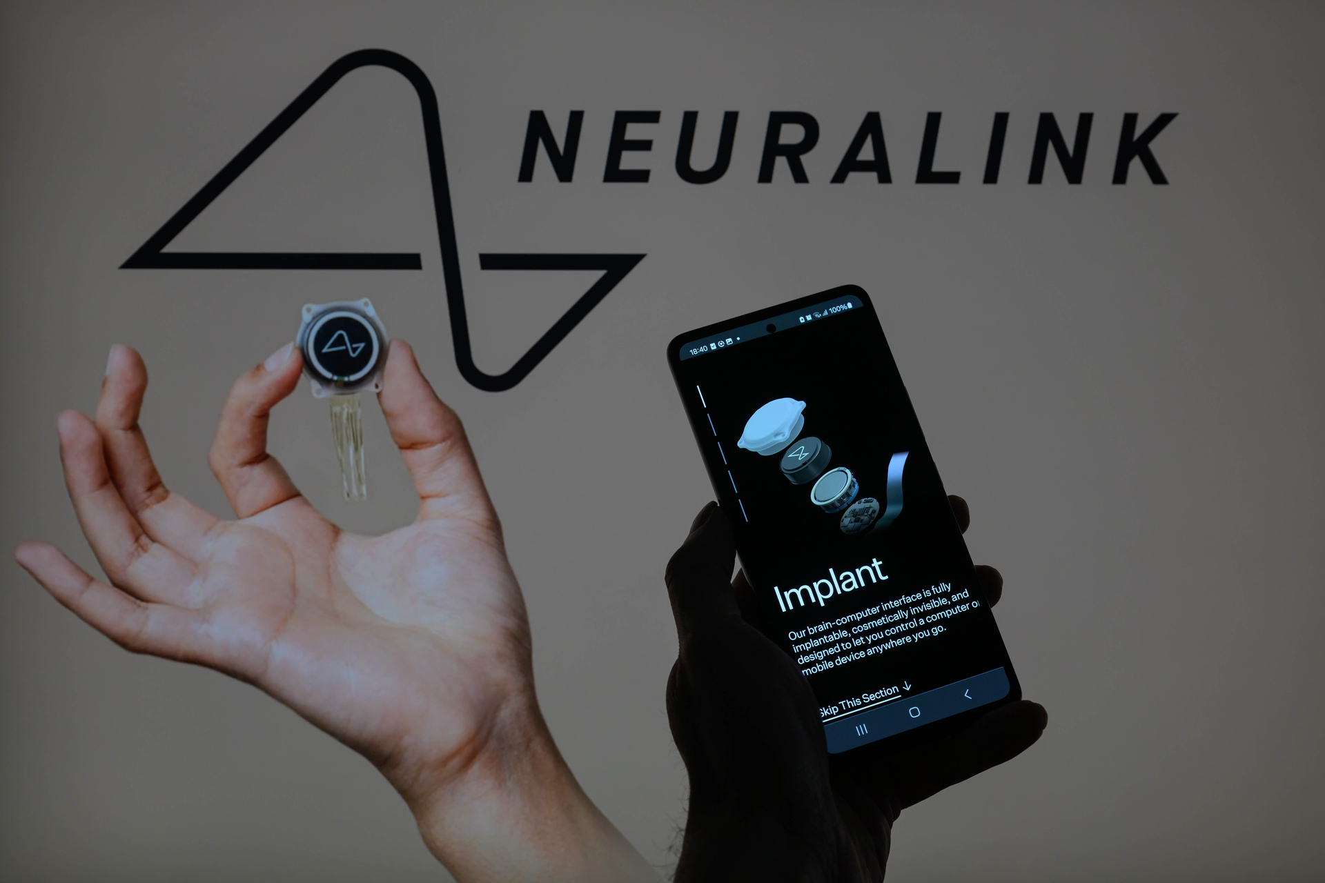 Neuralink testará implante cerebral para controle de dispositivos