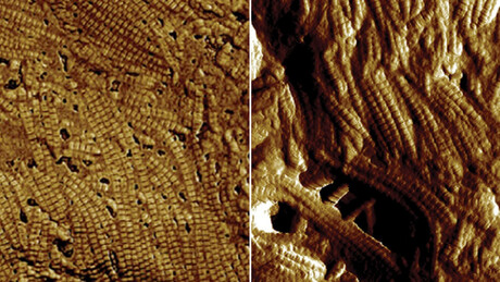 Cientistas russos criam pele artificial para tratar queimaduras e feridas crônicas