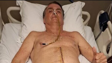 Bolsonaro mantém boa evolução clínica, diz boletim médico