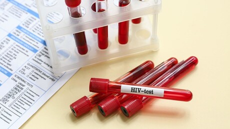 Cortes na USAID paralisa testes de HIV na África do Sul e ameaça vidas de mulheres e jovens