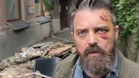 Varanda com cineasta americano desaba em Kiev enquanto ele gravava filme