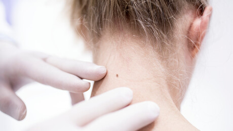 Estudo global mostra qual medicamento oferece esperança contra vários tipos de câncer