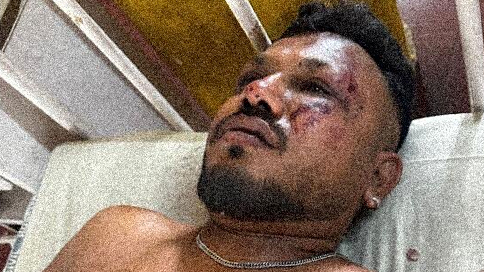 Sobrevivente é encontrado dentro do Boeing que caiu na Índia