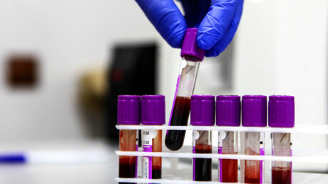 Rússia dá início aos testes clínicos das primeiras vacinas contra o câncer