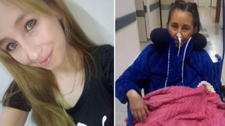 Cirurgia de laqueadura termina em pesadelo: jovem perde a perna e recebe coração novo