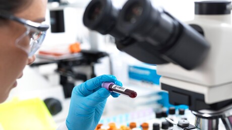 Cientistas brasileiros identificam proteínas promissoras na luta contra o câncer no sangue