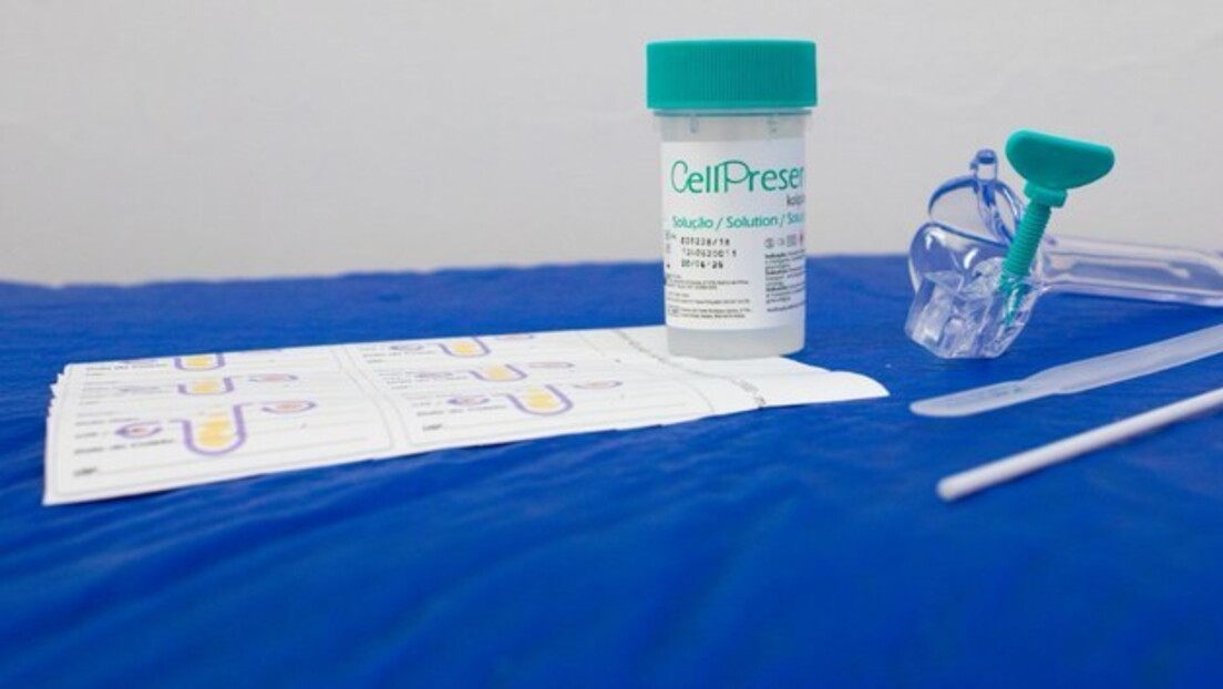 SUS passa a oferecer novo teste para detectar câncer de colo do útero