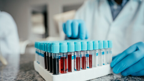 Rússia registra primeiro teste rápido do mundo para detectar hepatite B