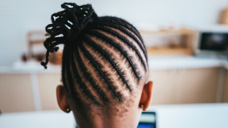 Médicos removem 280 gramas de cabelo do estômago de criança