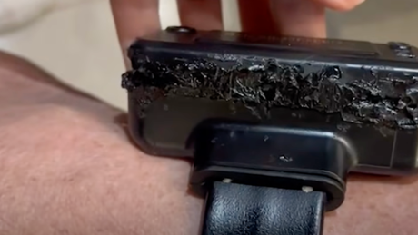 Bolsonaro admite que danificou tornozeleira com ferro de solda, em aparente tentativa de violá-la