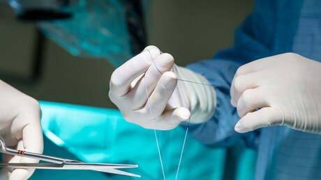 Russa vive sete anos com agulha esquecida dentro da barriga