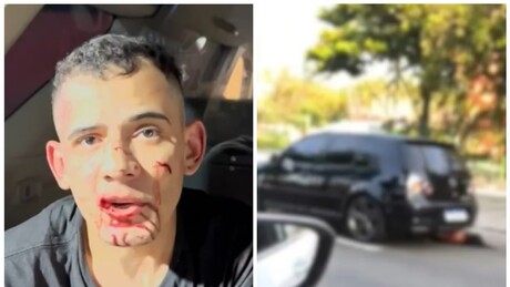 Suspeito detido nega conhecer mulher que foi arrastada por carro - VÍDEO