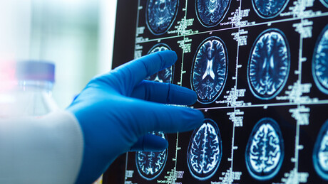 Cientistas dão dicas para deixar cérebro até 8 anos mais jovem