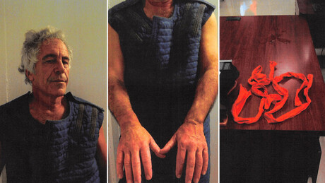 IMAGENS FORTES: fotos inéditas de Epstein após suposta tentativa de suicídio