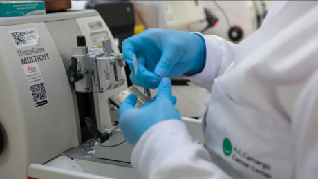 Brasil projeta 781 mil novos casos de câncer por ano até 2028 e alerta para desigualdade