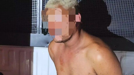 O agressor de 26 anos