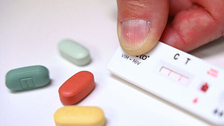 Estudo pode diminuir número de medicamentos no tratamento do HIV de 11 para 1