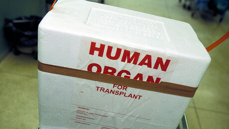 'Sacos de órgãos': Startup apoiada por bilionário quer criar corpos humanos sem cérebro