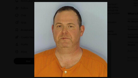 Médico é preso na Flórida acusado de retirar órgão errado de paciente