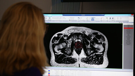 Brasil amplia acesso à radioterapia com inauguração de novos aceleradores lineares no SUS