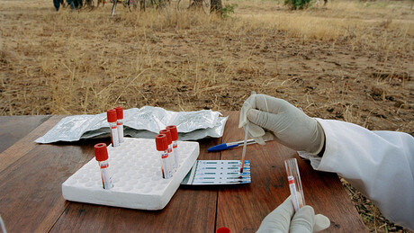 Cortes de verbas dos EUA no combate ao HIV faz número de casos graves subir em país africano