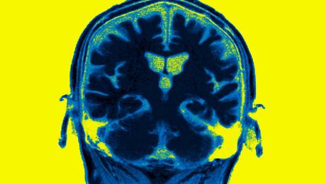 Cientistas revelam forma inesperada de retardar envelhecimento cerebral